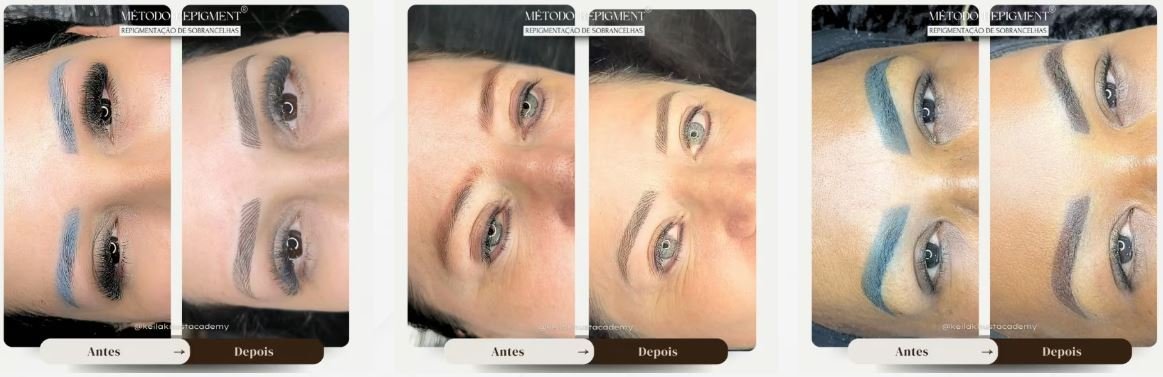 Opinião final sobre Método Repigment Balance