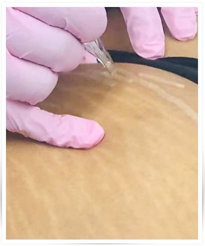 Para quem é Camuflagem de Estrias