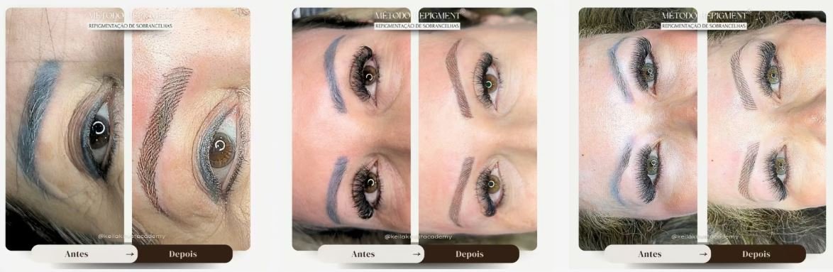 Vale a pena comprar Método Repigment Balance É confiável